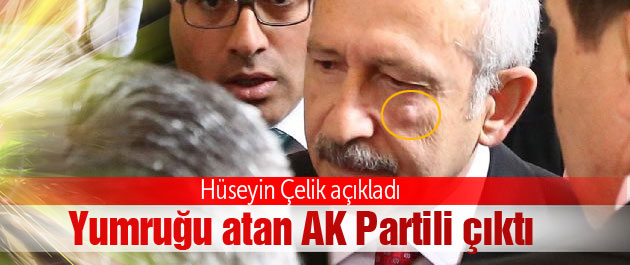 Saldırgan AK Parti üyesi çıktı SON DAKİKA